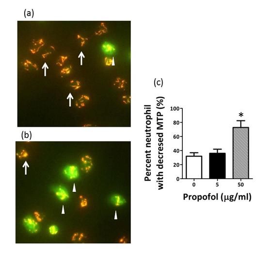 Figure 2: Effects of incubation with 50 µg/ml propofol for 5 h on neutrophil mitochondrial transmembrane potential (MTP) determined by JC-1 staining. Neutrophils were treated with 0 (a) or 50 μg/ml (b) propofol. Representative images of cells stained with JC-1 are shown. Arrows (red) indicate cells with JC-1 aggregates (high or normal MTP); Arrowheads (green) indicate cells with JC-1 monomers (decreased MTP). (c) Effects of propofol on the percentage of neutrophils with a decreased MTP. Data are expressed as means ± SD (n=8). *P < 0.01 vs. 0 or 5 μg/ml propofol.
