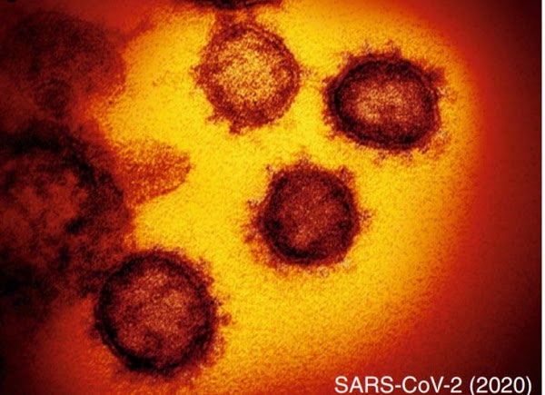 Figure 2: Structure of SARS -CoV-2 adapted from Kostarelos [20].