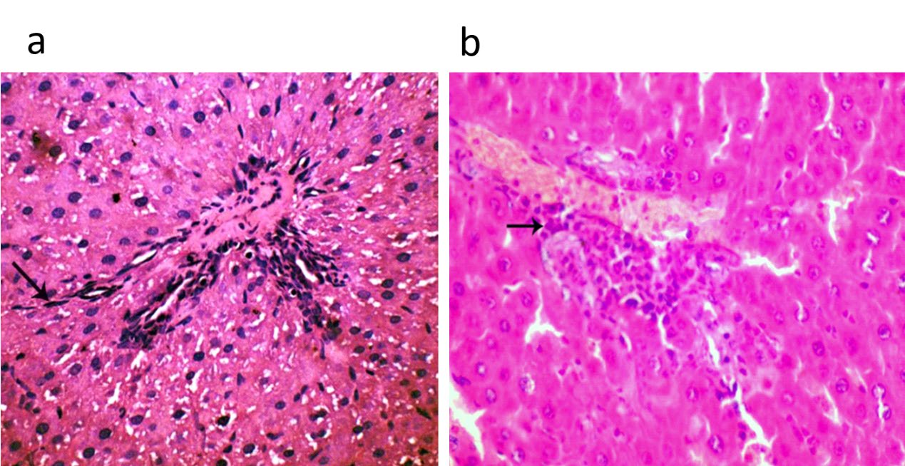 Figure 1: The depicted figure shown (a) Liver of lactating dams treated with 1/10 LD50 of CFP orally from 0th - 21th days postpartum showing intralobular fibroblastic and histiocytic infiltration in the hepatic tissue (arrow) in (HE, 400x). (HE, 400x) (b) Liver of suckling pups of treated dams with 1/10 LD50 of CFP orally from 0th - 21th days postpartum showing mild lymphocytic infiltration in hepatic tissue (arrow) (HE, 400x).