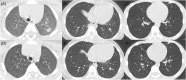 Figure 2: CT Scan in males children.
