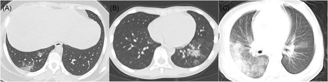Figure 3: CT Scan in children.