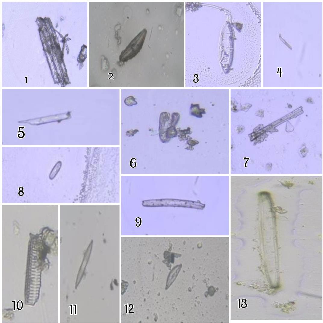 Figure 1: Microscopic View of Diatom Species. 1-Fragilaria, 2-Cymbella, 3-Nitzschia, 4-Achnanthes, 5-Fragilaria, 6-Pinnularia, 7-Fragilaria, 8-Pinnularia, 9-Eunotia, 10-Fragilaria, 11-Syndera, 12-Cymbella and 13-Tryblionella.