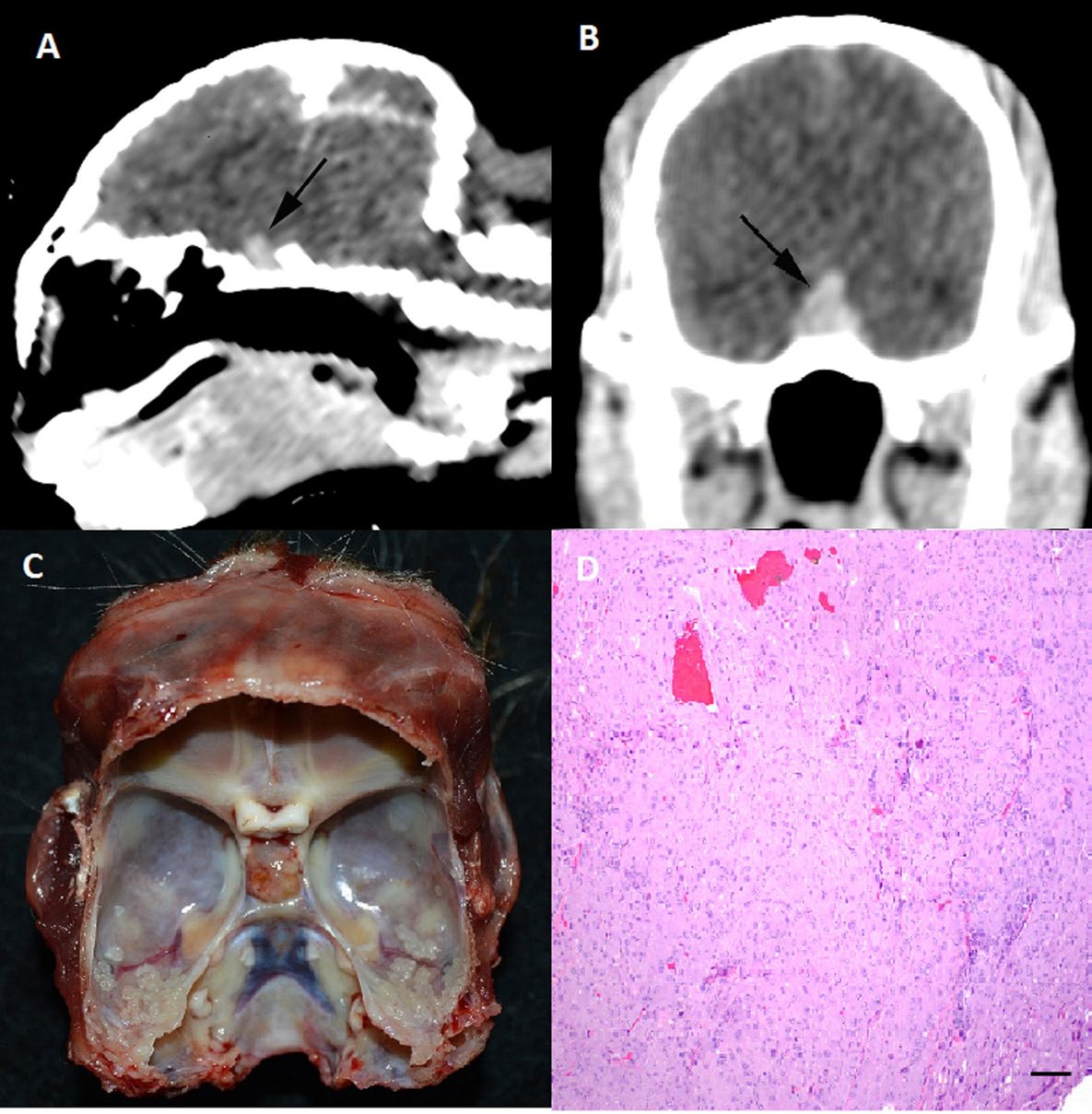 Figure 2: Sagittal (A) and transverse (B) plane post i.v. contrast computed tomography images from a golden lion tamarin showing a slightly dome-shaped; strongly contrast enhances mass arising from the pituitary fossa, consistent with a pituitary macroadenoma. Post mortem exam, cranium with the brain removed (C), the pituitary mass bulges from the hypophyseal fossa. Photomicrograph of pituitary mass (D). Neoplastic cells are arranged in irregular nests and cords and are polygonal with abundant eosinophilic granular cytoplasm, consistent with an adenoma of the pars intermedia. H&E, Bar = 100 µm.