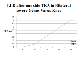 Figure 2: LLD after one side TKA in Bilateral Severe Genus Varus Knee.