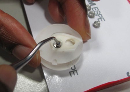 Figure 1: Stainless steel rod placed in prepared cavity contained with 30mg of resin cement.