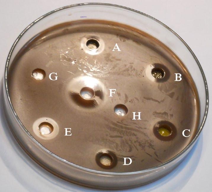 Figure 1: A photograph of a bacterial culture plate showing the S. mutans growth inhibitory effects of different solvent extracts of the Sri Lankan TBQ. The well A contains (methanol extract), B (ethyl acetate extract), C (hexane extract), D (water extract), E (0.2%chlorhexidine), F (Gentamycin), G (10% DMSO) and H (water).
