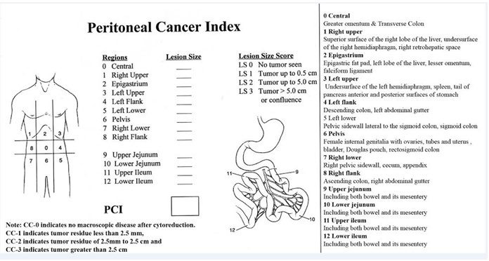Figure 1: Sugarbaker’s PCI chart.