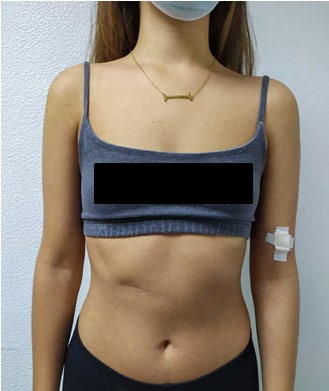 Figure 7: Confluent erythematous maculopapular rash.