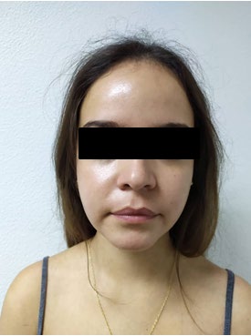 Figure 9: Rash remission day 14. Left arm.