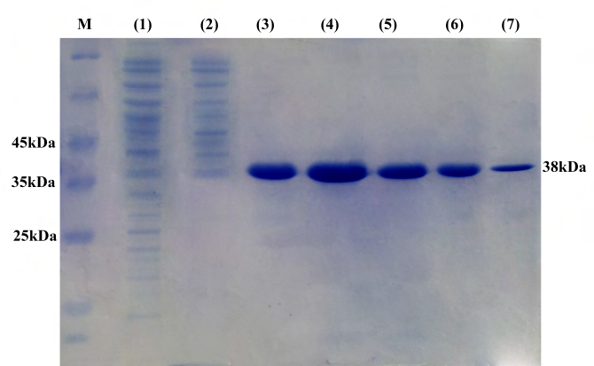 Figure 3: SDS-PAGE analysis of the expression of rOmpL1 protein. Lane (1) (2) non induced BL21 cells; Lane (3) – (7) pellet and supernatant fractions of lysates from induced E. coli BL21 cells of five Leptospira serovars.
