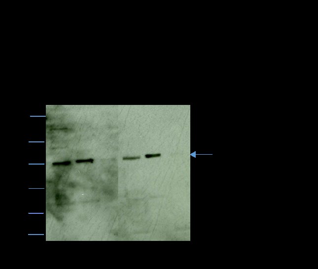 Figure 1: Western blot analyses immunostained with anti- FTase β showing total sperm lysate (lanes 1and 4), and, the soluble (lanes 2 and 5) and particulate (lanes 3 and 6) fractions of sonicated of caput (lanes 1, 2, and 3) and cauda (4, 5, and 6) epididymal spermatozoa. Each lane of caput and cauda represents cell fractions obtained from 2 X 106 spermatozoa. FTase β is only present in the soluble fraction of both caput and cauda epididymal spermatozoa.