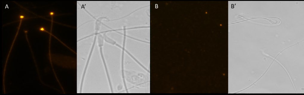 Figure 3: Fluorescence (A and B) and matched phase contrast (A′ and B′) microscopic examination of hamster cauda epididymal spermatozoa immunostained with anti-RAF Kinase polyclonal antibody (A) and with nonimmune IgG (B). Note the specific fluorescence of the sperm connecting piece and flagellum stained with anti- RAF-Kinase (A). Sperm incubated with nonimmune IgG exhibited no fluorescence (B).