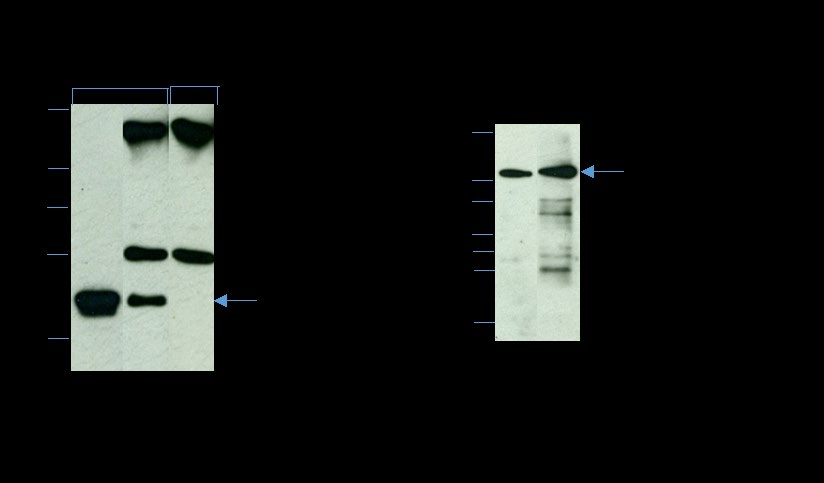 Figure 4: Identification of RAS-associated proteins by co- immunoprecipitation analysis. Triton X-100-soluble lysates of the isolated plasma membrane (PM) fraction (∼200 µg protein) were immunoprecipitated with anti-Pan-RAS (A and B) and analyzed by reducing SDS-PAGE on a 12% gel. A) Immunoblot of Triton X-100-soluble PM fraction (lane 1), and anti-Pan-RAS IP pellet (lane 2) immunostained with anti-RAS. Note that a complete recovery of RAS (21 kDa) was observed in the IP pellet (lane 2); both the heavy (50 kDa) and light (25 kDa) chains of IgG are evident. An identical lane (lane 3) of the anti-Pan-RAS IP pellet stained, with nonimmune mouse IgG (NI-IgG) shows only the heavy (50 kDa) and light (25 kDa) IgG chains but not the 21-kDa RAS polypeptide. B) Immunoblot of Triton X-100-soluble PM fraction (lane 1) and anti-Pan-RAS IP pellet (lane 2) immunostained with anti-RAF-Kinase. The 81-kDa RAF-Kinase is present in both the PM (lane 1) and the IP pellet (lane 2); the 50-kDa and 25-kDa IgG chains are also visible in the IP pellet. Our co-immunoprecipitation analysis reveals the interaction of RAS and RAF-Kinase.