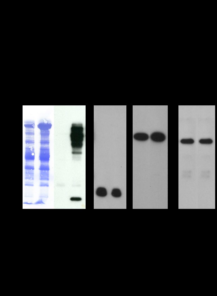 Figure 5: Western blots of noncapacitated (lanes 1, 3, 5, 7, and 9) and capacitated (lanes 2, 4, 6, 8, and 10) spermatozoa fractionated by reducing SDS-PAGE and stained with Coomassie Brilliant Blue (CBB) (lanes 1 and 2), immunostained with anti-phosphotyrosine (anti-pY20, lanes 3 and 4), anti-Pan-RAS (lanes 5 and 6), anti-PI3- Kinase p85 alpha (lanes 7 and 8), and anti-RAF-Kinase (lanes 9 and 10). Equal numbers of spermatozoa (107 cells) were loaded in each lane.