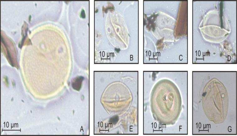 Figure 5: Fossil diporate Poaceae pollen grains from the sediment of Águas Claras region, Rio Grande do Sul.