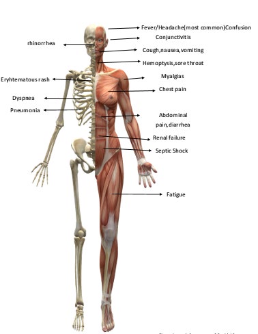 Figure 1: Symptoms of COVID-19.