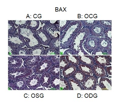 Figure 2: BCL-2 expressions in the testis tissue. BCL-2 expressions in the testis tissue; A: +3 expression, B: Negatif expression, C: +1 expression, D: +1 expression (Groups; A: CG, B: OCG, C: OSG, D: ODG).