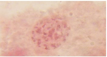 Figure 9: Observed meiotic cell division stage (Metaphase 1) in Periplaneta americana.