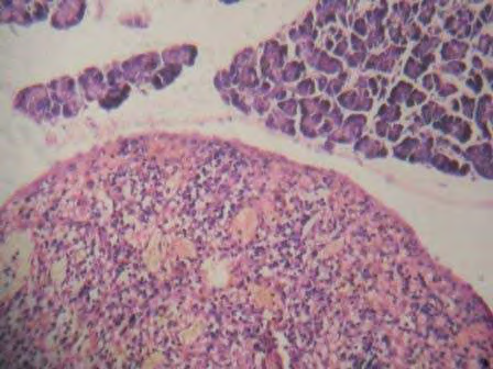 Figure 5: Group-c-Insulin treatment group rats showing proliferation of Beta cells when compared to Diabetic control rats.