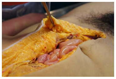 Figure 3: Fat sampling.