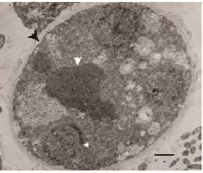 Figure 3: TEM. Excystation of Ent. moshkovskii. After effect of benzimidazole. Polynucleus cells vegetative form of Ent. moshkovskii. Scal bar: 1.0µ.