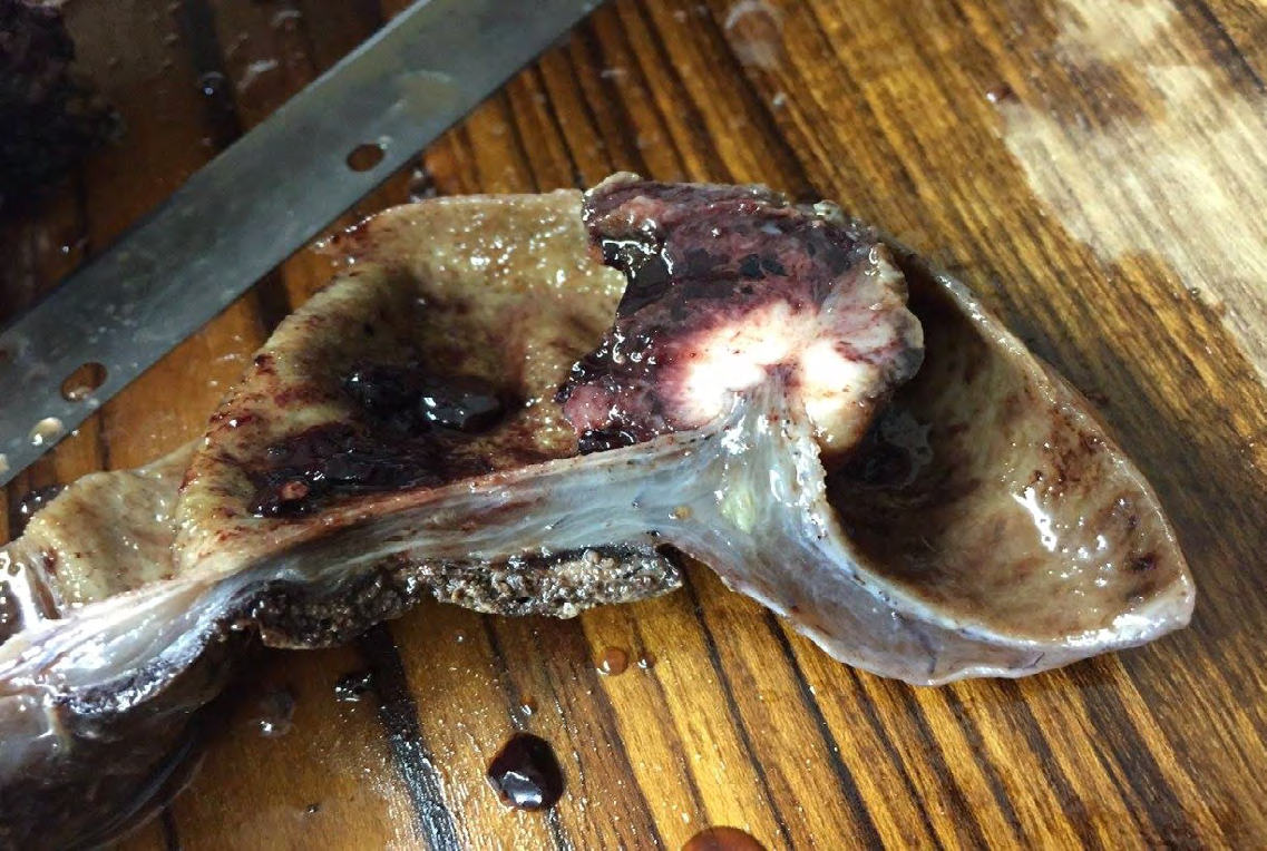 Figure 2: Gross image showing polypoidal growth.