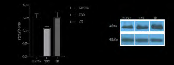 Figure 2: Results of Western blot analysis for Tyro3 receptor kinase among unexplained pregnancy loss decidua (URPLD), termination pregnancy decidua (TPD), and control endometrium (CE) groups. Tyro3 receptor kinase protein expression decreases on the TPD, not URPLD in the human first trimester to non-pregnancy. Result of all groups are non-significant (ns), P=0,21 for URPLD vs TPD, P=0,19 for TPD vs CE and P>0,99 for URPLD vs CE.