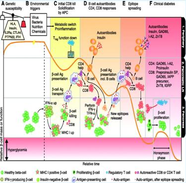 Figure 1: Courtesy ref no 13-How T1D might arise. This figure represents the beta-cell mass or function (represented by the orange line) as well as the different immunological phases (columns with alphabetized tabs on top) that occur in the relevant anatomical sites (rows with numerical tabs on the right). Specific events will be referred to via alphanumerical coordinates in the following explanation. Once the orange line of beta-cell function falls into the red zone, the individual is clinically diagnosed with type 1 diabetes. A complicated series of events precedes this and remains largely unnoticed. Initially, an unfortunate concurrence of genetic susceptibility (a1) and an environmental trigger (a2) sets an individual up for developing diabetes by causing two events. In the pancreas, beta-cells upregulate interferon (IFN)-α (b3) and subsequently MHC class I (c3). This exposes the beta-cells to attack by autoreactive CD8 T cells with specificity for antigens in the pancreas (c3). Consequently, the released beta-cell antigens are picked up by resident antigen-presenting cells (APC) (c3) and transferred to the pancreas-draining lymph node (LN) (c2). Meanwhile in the periphery (c1), the environmental trigger has caused a metabolomic switch creating a proinflammatory environment that favors effector T-cell responses over Treg function. Beta-cell antigens presented in this proinflammatory context and with CD4 help (c2) initiate conversion of B cells into plasma cells (d2) and the appearance of insulin autoantibodies (seroconversion) (d1). Also, autoreactive CD8 T cells are stimulated to proliferate (d2) and migrate into the pancreas (d3). The stress induced by this second wave of beta-cell killing (d3), which involves perforin, IFN-γ, and tumor necrosis factor (TNF)-α, causes some beta-cells to halt insulin production (pseudoatrophy). The killing also causes the release of new beta-cell antigens that are picked up by APCs, including migrated B cells (d3), and get shuttled to the pancreatic LN (d3-d2). This engages new specificities of CD4 and CD8 T cells (e2) and B cells (e1) in a process called epitope spreading. A subsequent wave of beta-cell killing is therefore more severe and usually results in severe depletion of beta-cell function and mass (e3). Surprisingly, the autoimmune inflammation can also stimulate some beta-cell proliferation (f3), so that the beta-cell mass temporarily resurrects. Also, Tregs can sometimes overpower and dampen the effector response (f3). The fluctuation between destructive autoreactive responses and the alleviation by immune regulation and beta-cell proliferation possibly creates a nonstop relapse-remitting profile of beta-cell mass (orange line). Eventually, the autoreactive response wins though, and T1D is diagnosed when only 10–30% of functional beta-cells remain. The remission after clinically diagnosed diabetes is termed the honeymoon phase (f3), a temporary state of relative self- sufficient insulin production.
