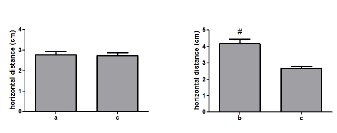 Figure 5: a: The horizontal distances between the tip of the lateral malleolus and incision A, b: The tip of the lateral malleolus and incision B, c: The tip of the lateral malleolus and the midpoint of the sural nerve and small saphenous vein, #significant difference relative to c (P < 0.05).