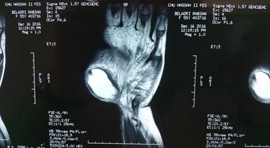 Figure 2: Intraoperative images.