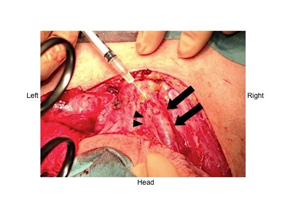 Figure 1: Presence of air bubble movement in the right external jugular vein. The arrows indicate the right external jugular vein and the arrowheads indicate a communicating vein.
