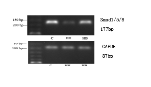 Figure 2: Expression levels of α-SMA, CD31 and Smad1/5/8 mRNA in each group. **_P_<0.01 vs C group; ##_P_<0.01 vs HH group.