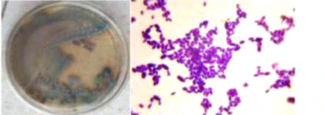 Figure 2: Candida growth cultivation report.