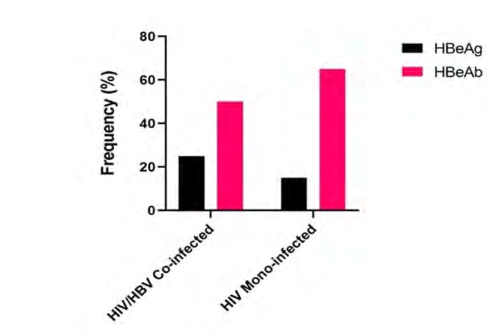 Figure 1: Frequency of HBeAg and HBeAb among HIV/HBV co-infected and HBV mono-infected patients in Ile-ife, Nigeria.