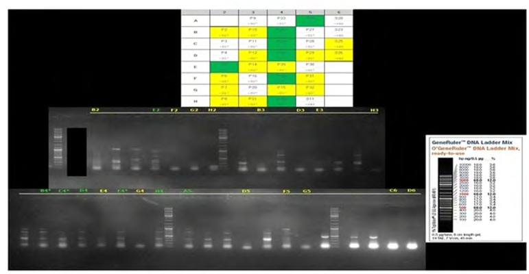 Figure 3: However, out of the 17 samples, seven (7) samples had low concentration/volume and were not sequenced while the remaining ten samples were sequenced. Of the ten samples, sequence data of four samples were not exploitable due to the presence of multiple peaks. Sequence data of the remaining exploitable six (6) sequences were used for the BCP/PC mutational analysis.