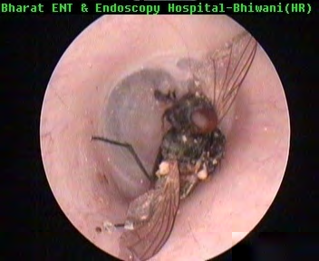 Figure 3: Photograph showing endoscopic intra aural view of fly.