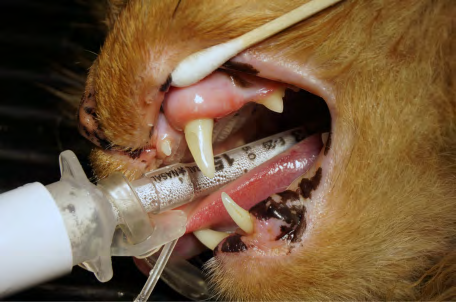 Figure 15: The screw retained restoration intraorally following torque of the fixation screw to secure the restoration to the implant.
