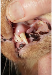Figure 16: Composite has been placed to seal the restoration screw access following placement of teflon tape over the fixation screw to complete the esthetic appearance of the restoration.