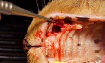 Figure 4: Densah bur is utilized in the extraction socket to condense the osteotomy improving the bone density (quality) that will house the implant.