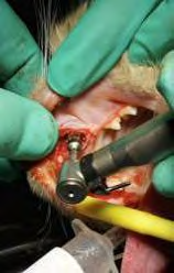 Figure 5: Implant placement is performed utilizing the surgical handpiece into the prepared osteotomy.