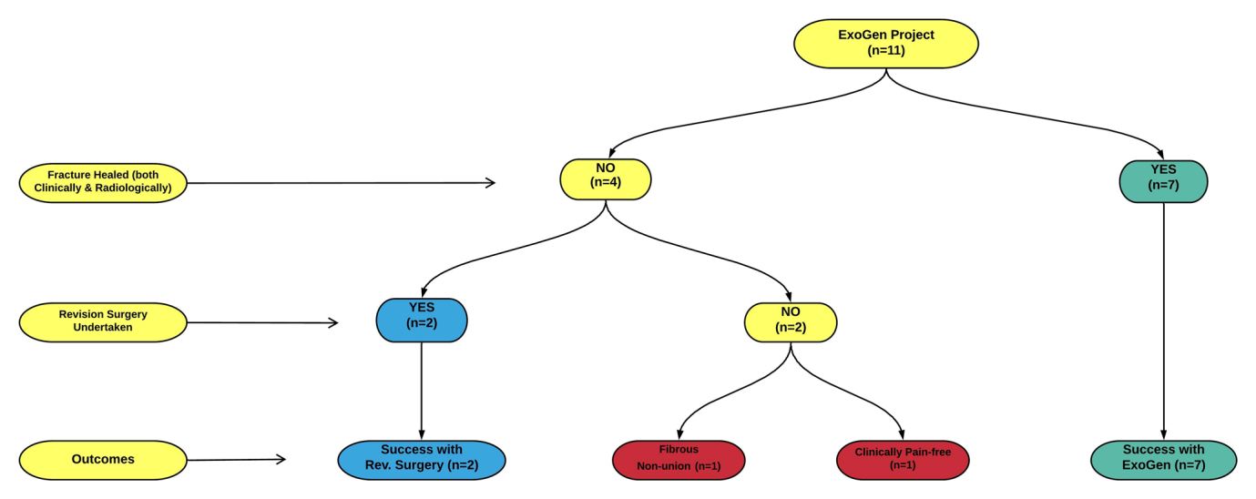 Figure 2: Two patients needed revision surgery to aid with fracture osteosynthesis that included diaphyseal fractures of: i) Humerus (needing re-fixation) and ii) Tibia + Fibula (needing implant removal and re-fixation). An illustrative example of ExoGen application for a forearm fracture is shown in Figure 3.