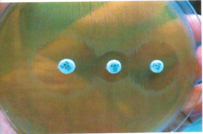 Figure 3: Plate of ESBL producing Escherichia coli with double disk synergy test.