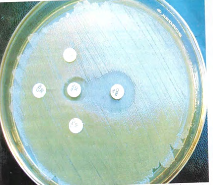 Figure 4: ESBL producing Klebsiella species dish undergoing double disk test.