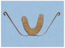 Figure 5: Post activator photographs and cephalogram pre and post activator.