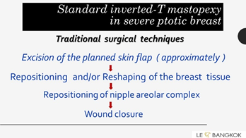 Figure 2: Standard or traditional techniques of mastopexy make excision of the planned skin flap (approximately) before and then repositioning and/or reshaping of the breast tissue and repositioning of nipple areolar complex (NAC) finally.