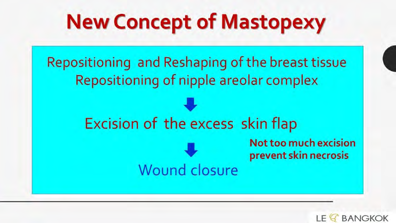 Figure 3: New concept techniques can more precise excision of skin flap because breast tissue and NAC are repositioned and reshaped before. The excess skin can excise accurately after subcutaneous tissue and breast tissues remove properly and before. Excision must be enough but not too much to prevent skin closure tightly and occur skin necrosis eventually.