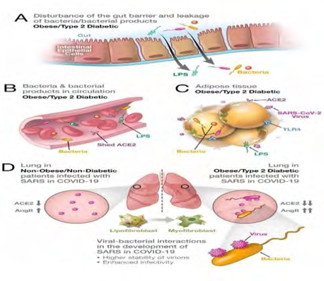 Figure 1: Diabetes and obesity are two comorbidities in Covid-19.