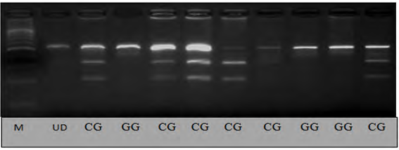 Figure 6: Electropherogram 3% Agarose gel showing banding pattern of genotype obtained with BpiI restriction enzyme digest at -420 C>G site of RETN gene. Lane M represents 100 bp DNA Marker while lane UD refers to the undigested PCR amplified (533bp) fragments. Genotypes are characterized as CG (533, 326 and 207bp) CC (326,207bp) and GG (533bp).