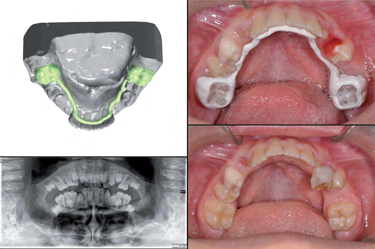 Figure 6: First case report.