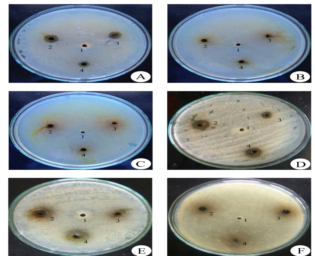 Figure 1: The antibacterial activity of piper betel performed against available pathogens. The zone of inhibitions mentioned are against highest concentration tested (20µg) only. 1: Control; 2: Chloroform extract; 3: Acetone extract; 4: Ethanol extract. A. Klebsiella pneumonia, B. Escherichiya coli, C. Pseudomonas aeruginosa, D. Enterococcus, E. Proteace species, F. Salmonella species.